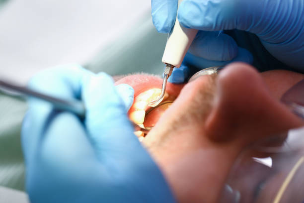 Best Emergency Tooth Extraction in Timpson, TX