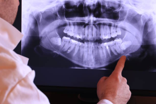 Best Emergency Treatment for Dental Infections or Abscesses in Timpson, TX